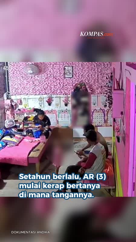 Balita Korban Malapraktik Di Bima, Kini Kerap Bertanya Di Mana Tangannya?