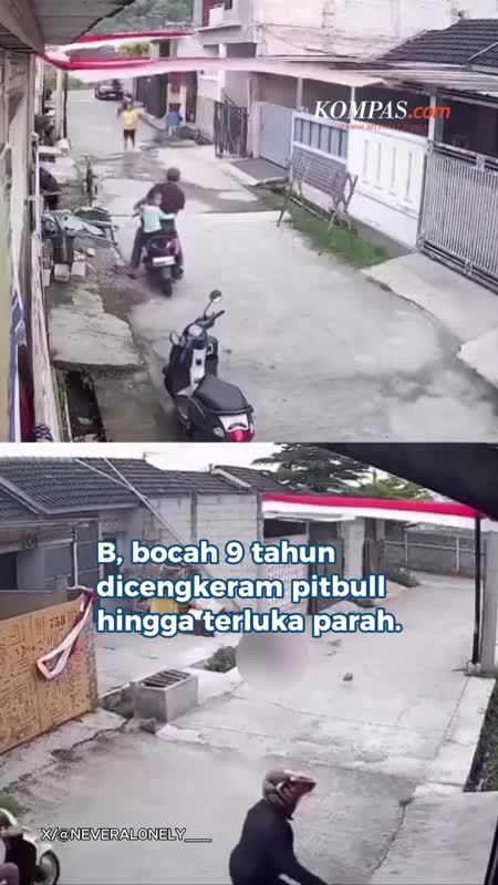 Anjing Pitbull Serang Bocah hingga Luka Parah, Kini Dikarantina Polisi