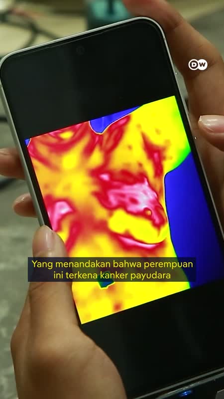 Deteksi Dini Kanker Payudara Pakai Smartphone